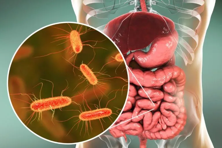 Disbiosi intestinale: cos'è, sintomi e come ristabilire l'equilibrio 7 Disbiosi intestinale: cos’è, sintomi e come ristabilire l’equilibrio