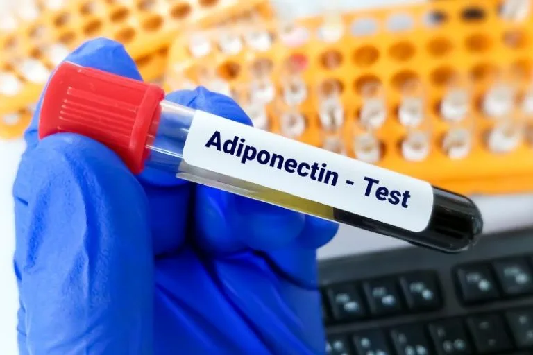 Adiponectina: l’ormone che regola il metabolismo e apre la strada al dimagrimento 7 Adiponectina: l’ormone che regola il metabolismo e apre la strada al dimagrimento