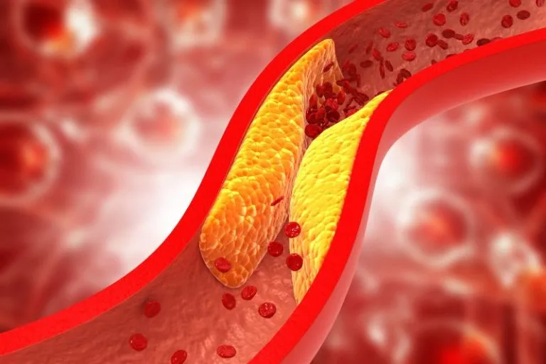 Colesterolo alto: tutto quello che devi sapere su LDL, HDL e trigliceridi (video) 5 Colesterolo alto: tutto quello che devi sapere su LDL, HDL e trigliceridi (video)